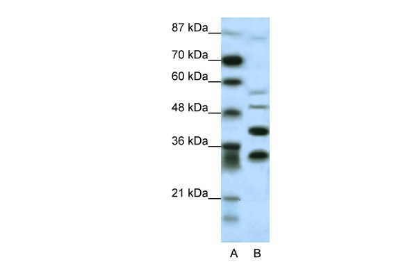 GFI1 antibody - N-terminal region (ARP31869_P050) in Human HepG2 using Western Blot