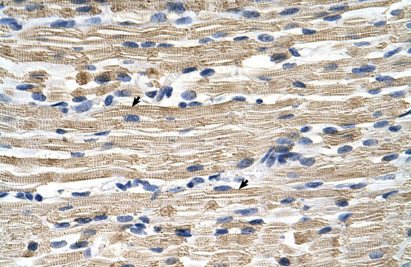 GSTM2 antibody - N-terminal region (ARP41818_P050) in Human Skeletal muscle using Immunohistochemistry