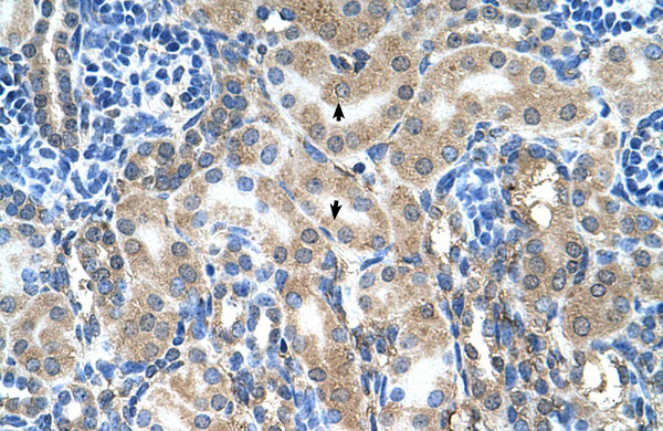 ABP1 antibody - C-terminal region (ARP41908_P050) in Human kidney using Immunohistochemistry