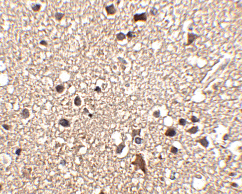 JPH3 Antibody (OAPB00790) in Human brain using Immunohistochemistry