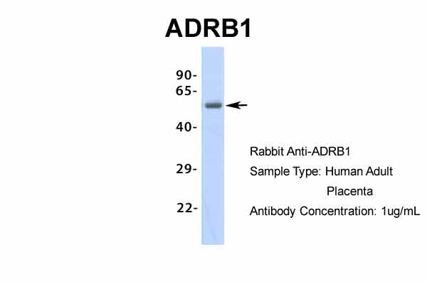 ADRB1 antibody - middle region (ARP36551_P050) in Hum. Adult Placenta using Western Blot