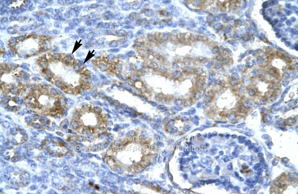 CDK7 antibody - C-terminal region (AVARP03009_P050) in Human kidney using Immunohistochemistry