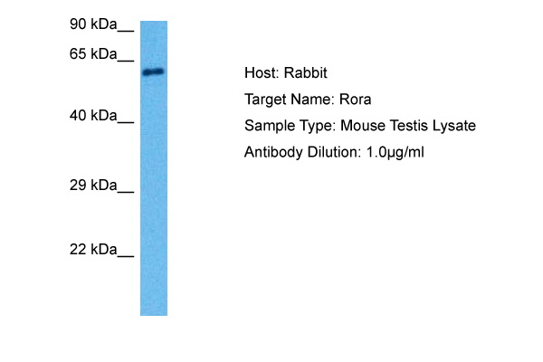 Rora Antibody - N-terminal region (ARP45643_P050) in Mouse Testis using Western Blot