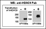 HDAC9 Antibody (N-term) (OAAB07338) in HeLa, HeLa-HDAC9 transfected using Western Blot