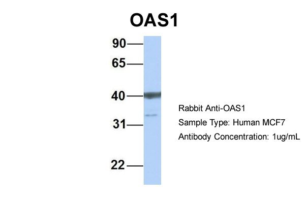 OAS1 antibody - C-terminal region (ARP30587_P050) in Human MCF7 using Western Blot
