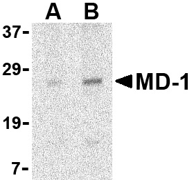 MD-1 Antibody (OAPB00422) in Daudi using Western Blot