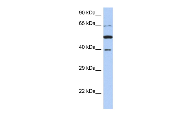 PNMA3 antibody - N-terminal region (ARP54945_P050) in Human 721_B using Western Blot