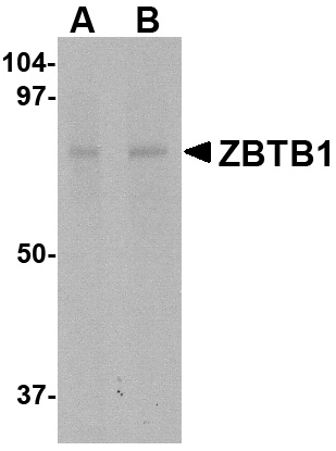 ZBTB1 Antibody (OAPB00801) in HepG2 using Western Blot