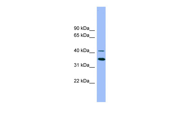 GATA5 antibody - middle region (ARP31627_P050) in Human HT1080 using Western Blot