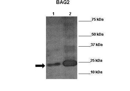 Arnt antibody - C-terminal region (ARP30979_P050) in Human placenta using Western Blot