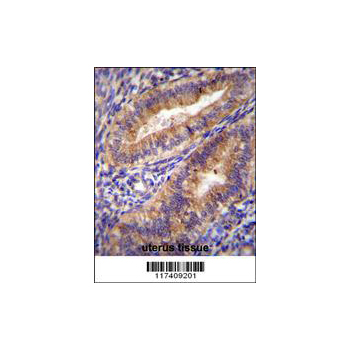 PTGS2 antibody (center region (OAAB07800) in Human Uterus using Immunohistochemistry