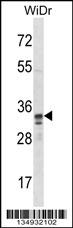 SPI1 Antibody (C-term) (OAAB11181) in WiDr using Western Blot
