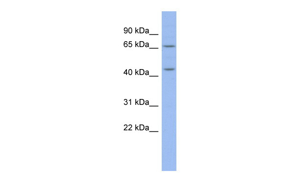 MIER3 antibody - middle region (ARP39920_P050) in Human COLO205 using Western Blot