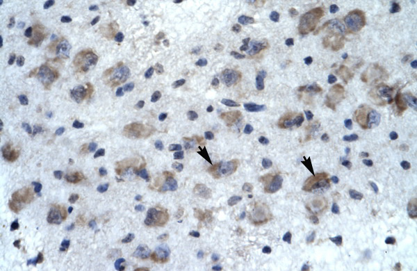 KCNH5 antibody - N-terminal region (ARP35478_P050) in Human Brain using Immunohistochemistry