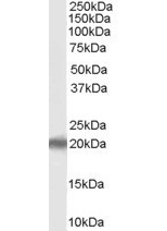 PERP Antibody (OAEB02187) in human livercells using Western Blot