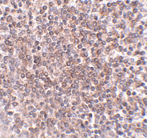 OCC-1 Antibody (OAPB00816) in human spleen using Immunohistochemistry