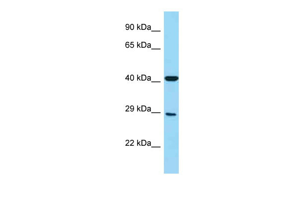 FCGR3A antibody - middle region (ARP63559_P050) in Human Placenta using Western Blot