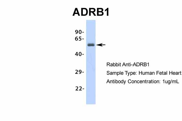 ADRB1 antibody - middle region (ARP36551_P050) in Hum. Fetal Heart using Western Blot