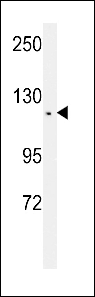 TSH2 Antibody (N-term) Affinity Purified Rabbit Polyclonal Antibody (0.1 mg) (OAAB02705) in CEM using Western Blot