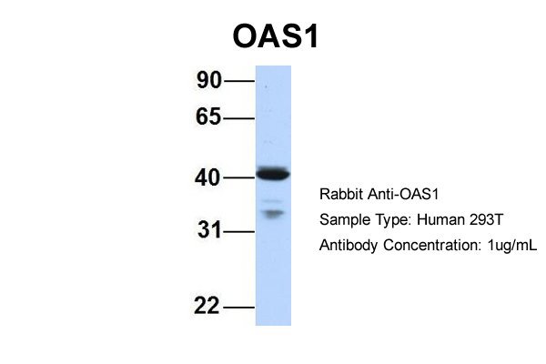 OAS1 antibody - C-terminal region (ARP30587_P050) in Human HEK293T using Western Blot