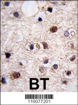 JMJD3 Antibody (N-term) (OAAB07251) in human brain tissue using immunohistochemistry