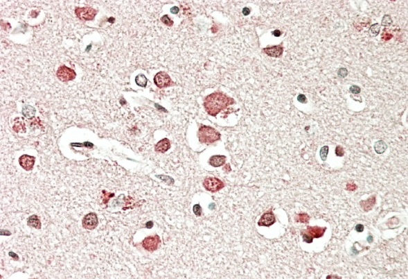 NBEA Antibody (OAEB02210) in Human Cerebral Cortex tissue using Immunohistochemistry
