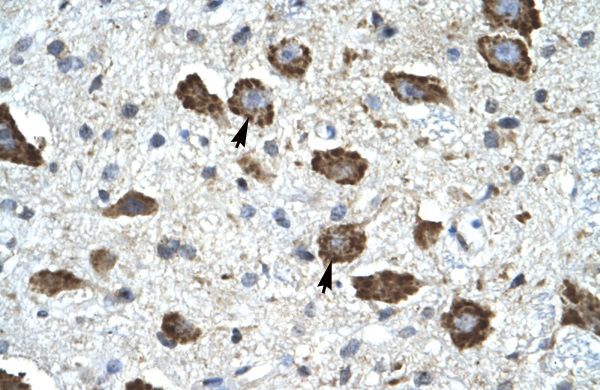 KCNIP2 antibody - N-terminal region (ARP35497_P050) in Human Brain using Immunohistochemistry