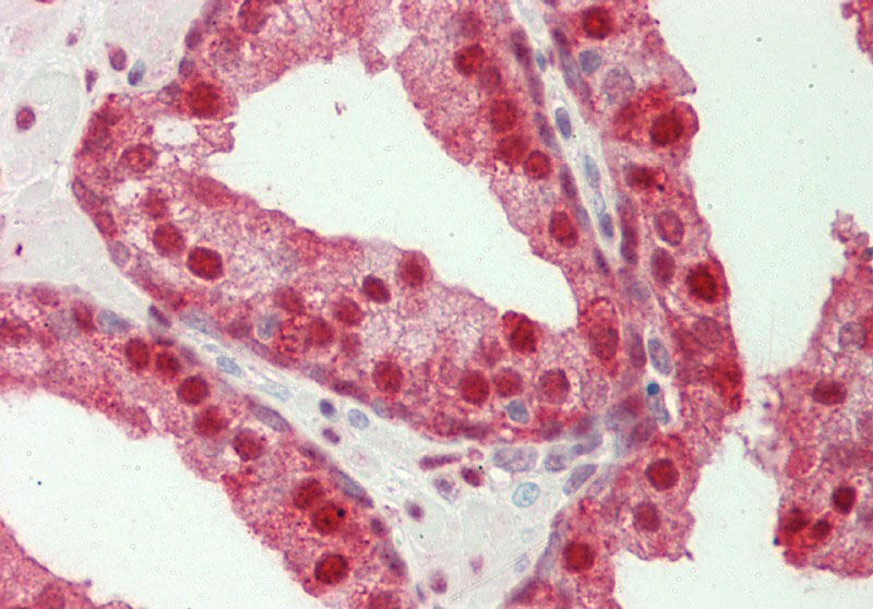 GBP2 antibody - N-terminal region (ARP54714_P050) in Human Prostate using Immunohistochemistry