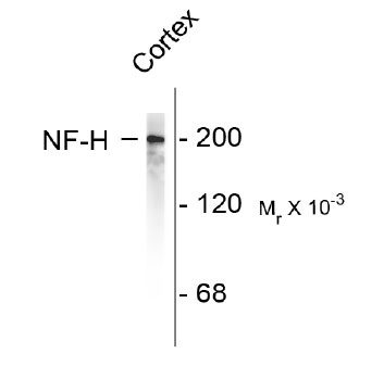 Anti-Neurofilament H (NF-H) (OAPC00025) in Rat cortex tissue using Western Blot
