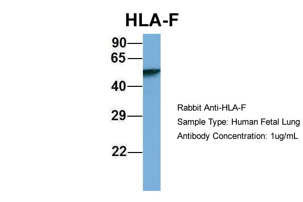 HLA-F antibody - N-terminal region (ARP49410_P050) in Hum. Fetal Lung using Western Blot
