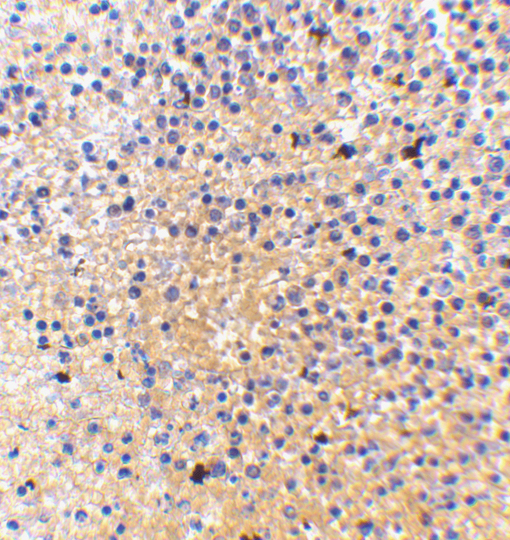 MD-1 Antibody (OAPB00422) in human spleen using Immunohistochemistry