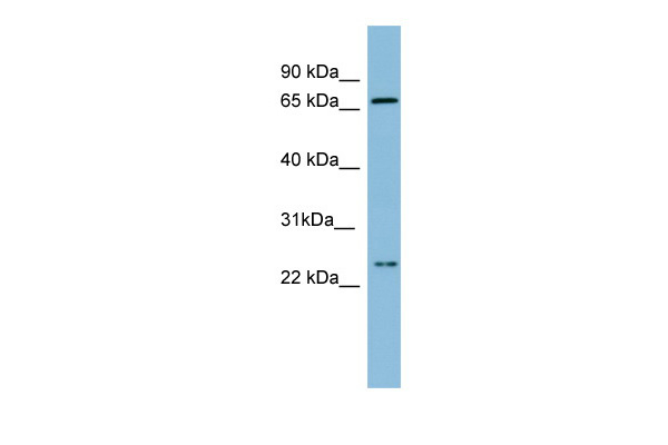 SLC6A8 antibody - middle region (ARP42249_P050) in Human Small Intestine using Western Blot