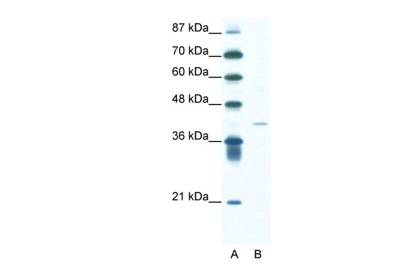 HIF1AN antibody - N-terminal region (ARP32903_T100) in Human Jurkat using Western Blot