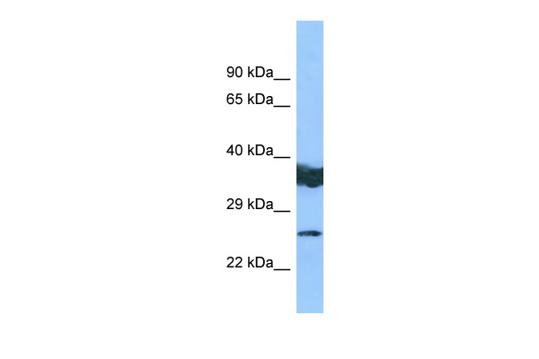 LYPLAL1 Antibody - middle region (ARP66204_P050) in Human COLO205 using Western Blot