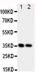 CD68 Polyclonal Antibody (OABB00472) in Rat Spleen,Lung tissue using Western Blot