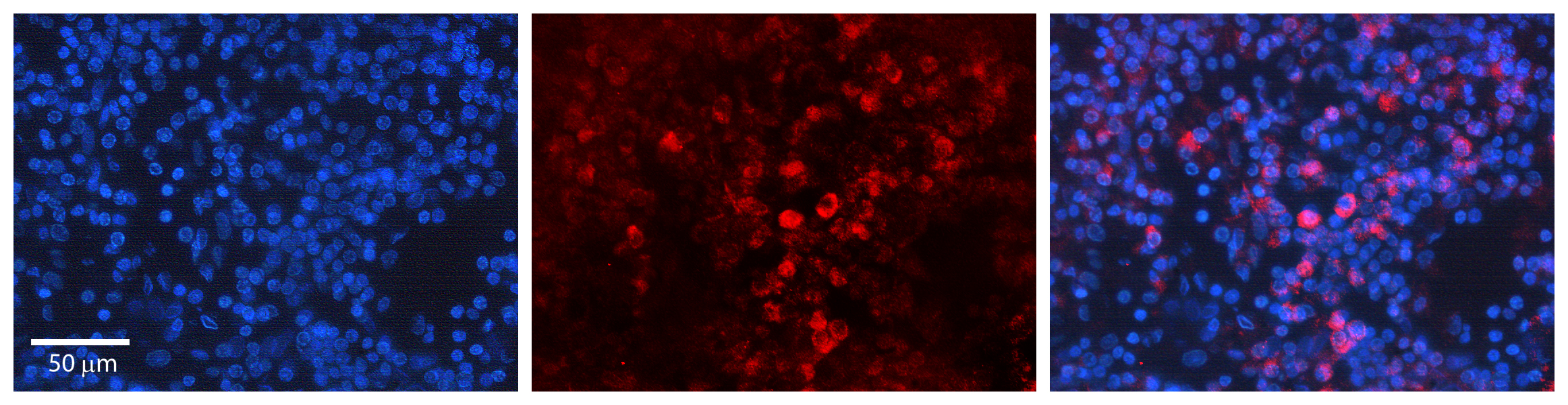 BAK1 antibody - N-terminal region (ARP30473_P050) in Human Lymph Node using Immunohistochemistry