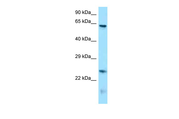 Runx1t1 antibody - N-terminal region (ARP58128_P050) in Mouse Brain using Western Blot