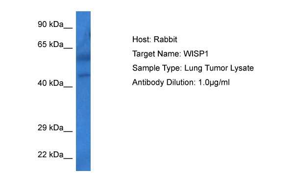 WISP1 Antibody - N-terminal region (ARP63883_P050) in Human Lung Tumor using Western Blot