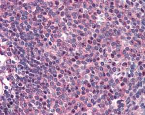 CARD11 Antibody (OAEB02396) in Human Spleen using Immunohistochemistry