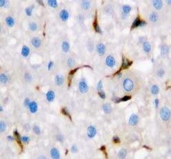 CD68 Polyclonal Antibody (OABB00472) in Rat Liver tissue using Immunohistochemistry