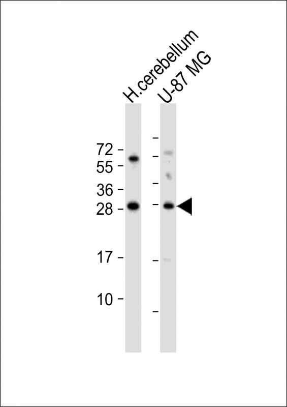 BDNF antibody - C-terminal region (OAAB05026) using Western Blot