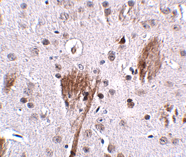 SPG11 Antibody (OAPB00830) in mouse brain using Immunohistochemistry
