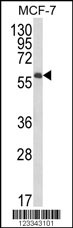 IL10RA Antibody (Center) (OAAB05365) in MCF-7 using Western Blot