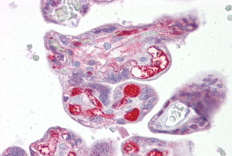 SLC26A4 antibody - middle region (ARP41739_P050) in Human Placenta using Immunohistochemistry