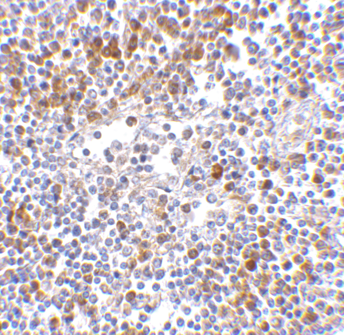 MDA5 Antibody (OAPB00490) in Human Lymph Node using Immunohistochemistry