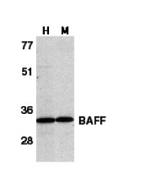 BAFF Antibody (0.1 mg)(OAPB00088) in Human HL60, Mouse Spleen using Western blot.