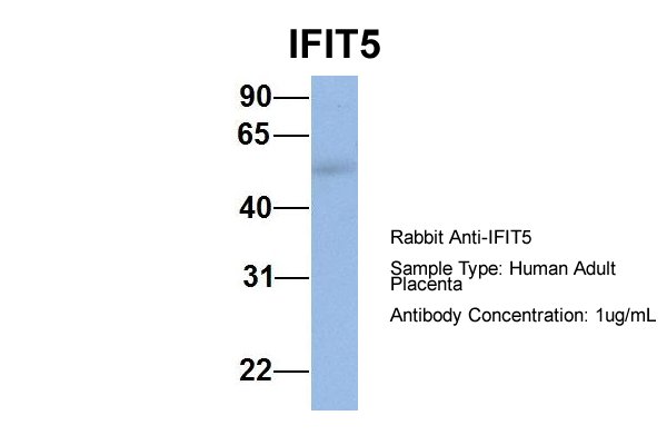 IFIT5 antibody - middle region (ARP54898_P050) in Hum. Adult Placenta using Western Blot