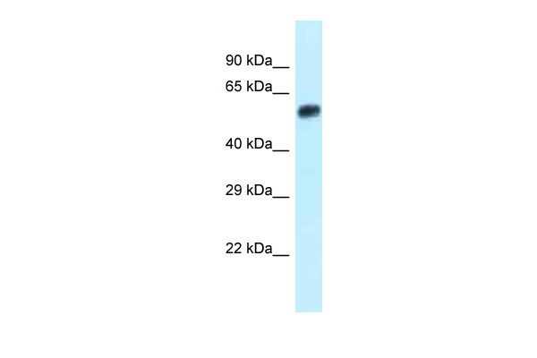 Eepd1 antibody - N-terminal region (ARP48411_P050) in Mouse Small Intestine using Western Blot