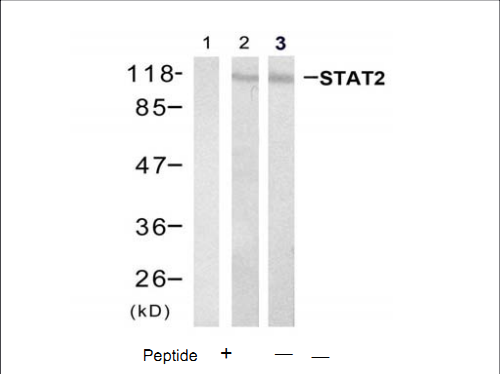 STAT2 Antibody (OASC00366) in Hela using Western Blot