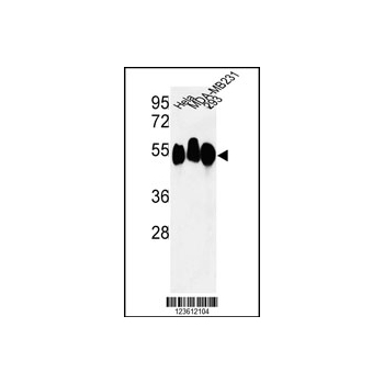 RBBP7 antibody - N-terminal region (OAAB05422) in Hela, MDA-MB231, 293 using Western Blot